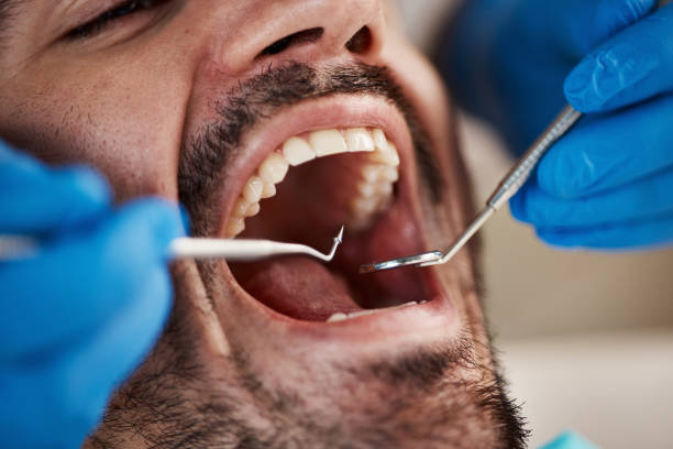 Best Emergency Broken Tooth Repair in Callahan, FL